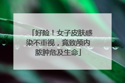 好险！女子皮肤感染不重视，竟致颅内脓肿危及生命